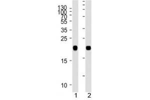 NRAS antibody western blot analysis in 1) human A431 and 2) rat C6 lysate.