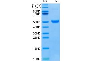 Human DKK1 C terminal Domain on Tris-Bis PAGE under reduced condition.