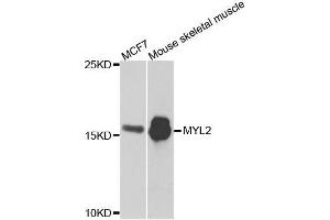 Western blot analysis of extracts of various cell lines, using MYL2 antibody. (MYL2 anticorps  (AA 1-166))