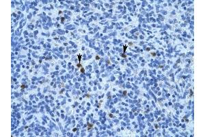 Annexin A3 antibody was used for immunohistochemistry at a concentration of 4-8 ug/ml to stain Spleen cells (arrows) in Human Spleen.