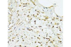 Immunohistochemistry of paraffin-embedded Human vermiform appendix using TRIM15 Polyclonal Antibody at dilution of 1:100 (40x lens). (TRIM15 anticorps)