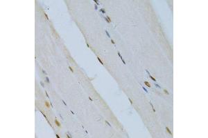 Immunohistochemistry of paraffin-embedded rat skeletal muscle using MAPK3 Antibody.