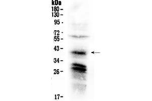 Western blot analysis of CXCR4 using anti-CXCR4 antibody . (CXCR4 anticorps  (C-Term))