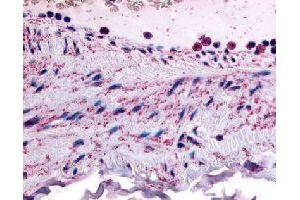 Immunohistochemical (Formalin/PFA-fixed paraffin-embedded sections) staining in human vascular smooth muscle with PTPMT1 polyclonal antibody . (PTPMT1 anticorps)