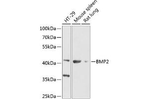 Western blot analysis of extracts of various cell lines, using BMP2 Antibody (ABIN6127494, ABIN6137595, ABIN6137596 and ABIN6216531) at 1:1000 dilution. (BMP2 anticorps  (AA 1-100))