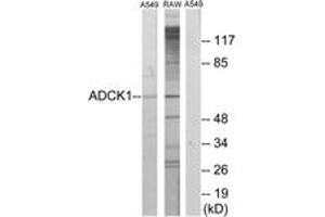 Western Blotting (WB) image for anti-AarF Domain Containing Kinase 1 (ADCK1) (AA 251-300) antibody (ABIN2889657) (ADCK1 anticorps  (AA 251-300))