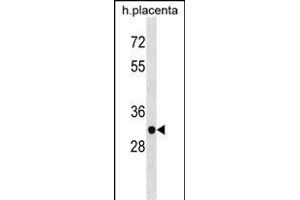 ZN Antibody (N-term) (ABIN1538903 and ABIN2838229) western blot analysis in human placenta tissue lysates (35 μg/lane). (ZNF783 anticorps  (N-Term))