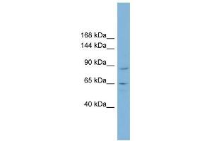 MGC16169 antibody used at 1 ug/ml to detect target protein. (TBCK anticorps  (Middle Region))