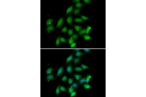 Immunofluorescence analysis of HeLa cells using PPP2CA antibody (ABIN5974047). (PPP2CA anticorps)