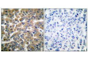 anti-GR (Internal Region), (pSer211) antibody