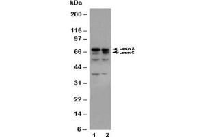 Western blot testing of Lamin A/C antibody and Lane 1:  HeLa;  2: A431 cell lysate (Lamin A/C anticorps  (AA 455-469))