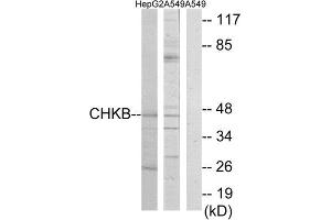 Western Blotting (WB) image for anti-Choline Kinase beta (CHKB) (C-Term) antibody (ABIN1850102) (CHKB anticorps  (C-Term))
