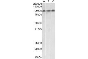 ABIN4902793 (0. (VPS16 anticorps  (Isoform 1))