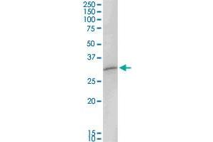 MAGEA8 MaxPab rabbit polyclonal antibody.