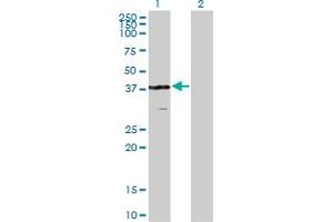 Western Blot analysis of VPS26A expression in transfected 293T cell line by VPS26A monoclonal antibody (M02), clone 1C4. (VPS26A anticorps  (AA 228-327))