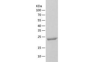 Western Blotting (WB) image for ClpP Caseinolytic Peptidase, ATP-Dependent, Proteolytic Subunit Homolog (E. Coli) (CLPP) (AA 57-277) protein (His tag) (ABIN7122410)