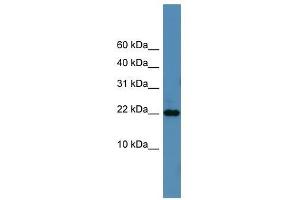 Western Blot showing SFRS12IP1 antibody used at a concentration of 1-2 ug/ml to detect its target protein. (SFRS12IP1 anticorps  (N-Term))