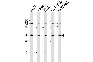 All lanes : Anti-ETV7 Antibody (C-term) at 1:2000 dilution Lane 1: A431 whole cell lysate Lane 2: Jurkat whole cell lysate Lane 3: K562 whole cell lysate Lane 4: NCI- whole cell lysate Lane 5: U-87 MG whole cell lysate Lysates/proteins at 20 μg per lane. (ETV7 anticorps  (C-Term))