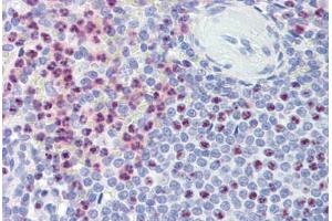 Spleen, Human: Formalin-Fixed, Paraffin-Embedded (FFPE) (PKD1 anticorps  (AA 4289-4300))