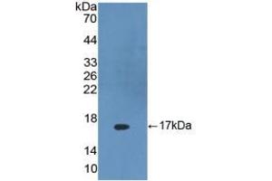 Figure. (DKK4 anticorps  (AA 107-212))