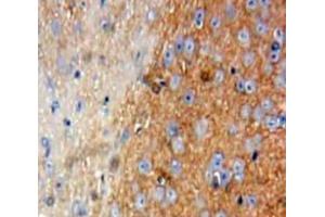 IHC-P analysis of Brain tissue, with DAB staining. (Talin anticorps  (AA 2293-2536))