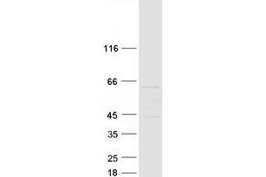 Validation with Western Blot