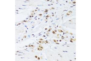 Immunohistochemistry of paraffin-embedded human stomach using GABPB1 Antibody (ABIN2562720) at dilution of 1:100 (40x lens). (GABPB1 anticorps)