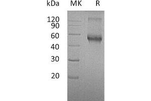 Western Blotting (WB) image for Activin A Receptor Type II-Like 1 (ACVRL1) protein (Fc Tag) (ABIN7320736)
