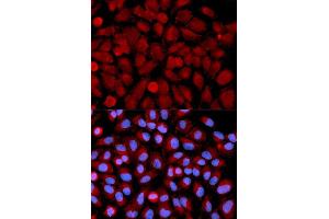 Immunofluorescence analysis of U2OS cell using MAPK9 antibody.