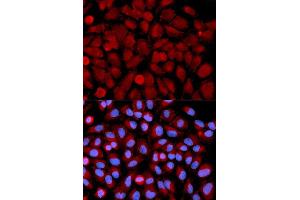 Immunofluorescence analysis of U2OS cell using MAPK9 antibody. (JNK2 anticorps  (AA 1-424))