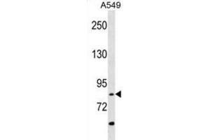 Western Blotting (WB) image for anti-Receptor-Interacting Serine-threonine Kinase 4 (RIPK4) antibody (ABIN3003506)