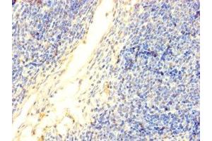 Immunohistochemistry of paraffin-embedded human thymus tissue using DNTT antibody at dilution of 1:100. (TdT anticorps  (AA 1-509))