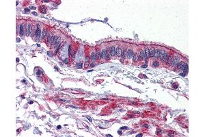 Anti-ACVR1 antibody IHC of human lung.