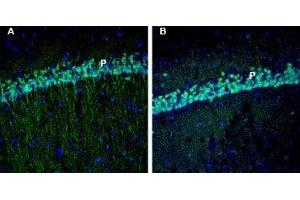 Expression of EphA3 in rat and mouse hippocampus - Immunohistochemical staining of perfusion-fixed frozen rat and mouse brain sections with Anti-EphA3 (extracellular) Antibody (ABIN7043123, ABIN7044245 and ABIN7044246), (1:200), followed by goat anti-rabbit-AlexaFluor-488. (EPH Receptor A3 anticorps  (Extracellular, N-Term))