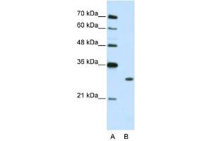 WB Suggested Anti-MBNL1  Antibody Titration: 2. (MBNL1 anticorps  (C-Term))