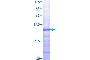 Image no. 1 for Enhancer of Zeste Homolog 2 (EZH2) (AA 1-110) protein (GST tag) (ABIN1353285)