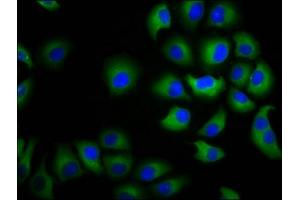 Immunofluorescence staining of A549 cells with ABIN7146688 at 1:100, counter-stained with DAPI. (CHST3 anticorps  (AA 316-427))