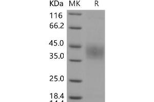Western Blotting (WB) image for Protein C Receptor, Endothelial (PROCR) protein (His tag) (ABIN7320123)