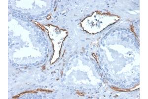 Formalin-fixed, paraffin-embedded human prostate stained with CD31 Mouse Monoclonal Antibody (PECAM1/3527). (CD31 anticorps  (AA 625-738))