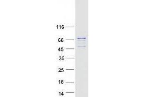 Validation with Western Blot