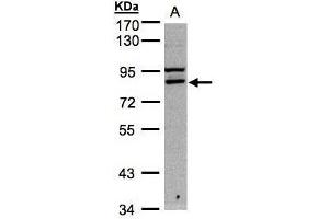 WB Image Sample A: 30μg of Hep G2 whole cell lysate , 7. (FASTKD1 anticorps)