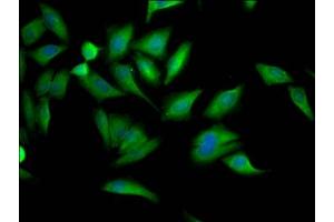 Immunofluorescence staining of Hela Cells with ABIN7127669 at 1:50, counter-stained with DAPI. (Recombinant PCYT1A anticorps)