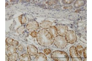 Immunoperoxidase of monoclonal antibody to TLN1 on formalin-fixed paraffin-embedded human small Intestine. (TLN1 anticorps  (AA 1052-1149))