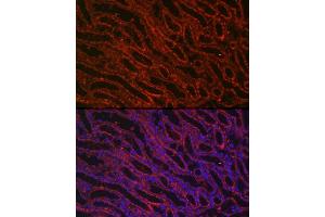 Immunofluorescence analysis of Mouse kidney cells using BMP7 antibody (ABIN3021108, ABIN3021109, ABIN3021110 and ABIN6213955) at dilution of 1:150.