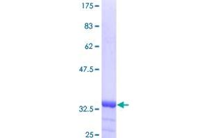 Image no. 1 for Inversin (INVS) (AA 1-101) protein (GST tag) (ABIN1307995)