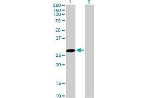Western Blot analysis of CCBL1 expression in transfected 293T cell line by CCBL1 monoclonal antibody (M02), clone 1B12. (CCBL1 anticorps  (AA 1-374))