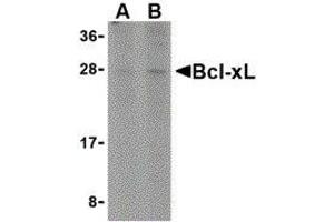 Western Blotting (WB) image for anti-BCL2-Like 1 (BCL2L1) (C-Term) antibody (ABIN2477605) (BCL2L1 anticorps  (C-Term))