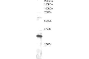 ABIN184710 staining (1µg/ml) of Jurkat lysate (RIPA buffer, 30µg total protein per lane). (DKK4 anticorps  (C-Term))