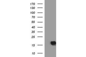 Image no. 1 for anti-SIVA1, Apoptosis-Inducing Factor (SIVA1) antibody (ABIN1500941) (SIVA1 anticorps)