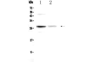 Western blot analysis of Oncostatin M using anti-Oncostatin M antibody . (Oncostatin M anticorps  (AA 25-206))